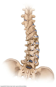 omurga-bozukluklari-spinal-deformiteler-1-skolyoz-6952.jpg