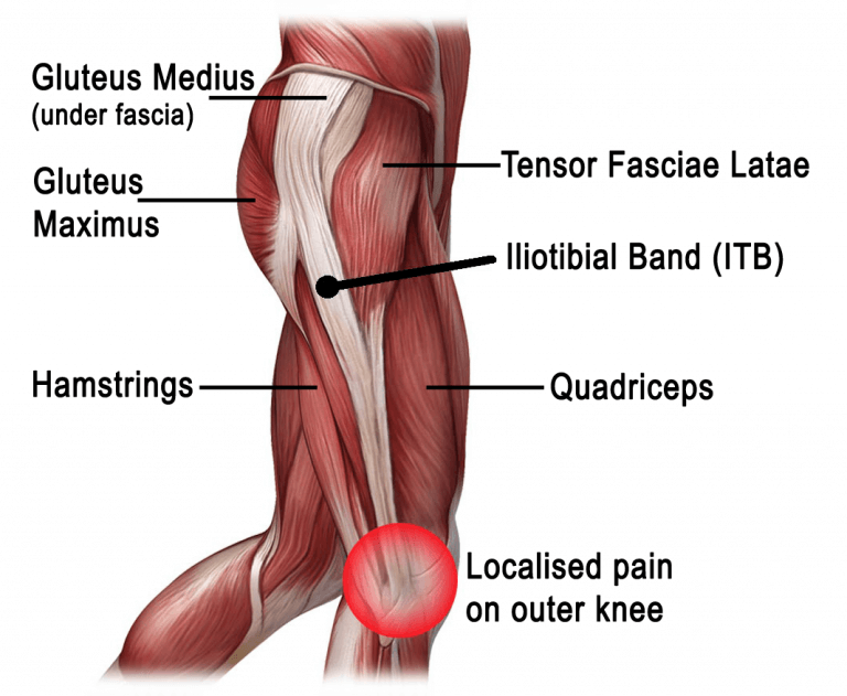 Iliotibial tract мышца